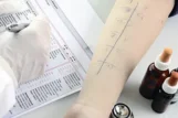 Alergije pliva zdravlje