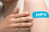 HPV